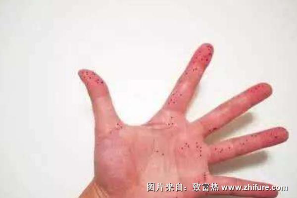 手上有辣椒很辣怎么辦