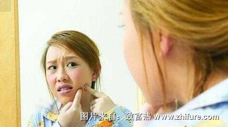 黃褐斑和雀斑的區別