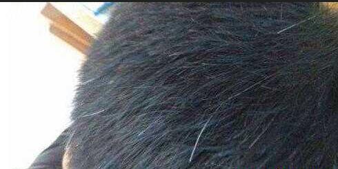 少年白還能變黑發嗎？少年白為什么還能變黑發