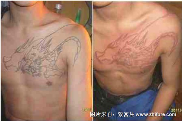 鴿子血紋身效果圖