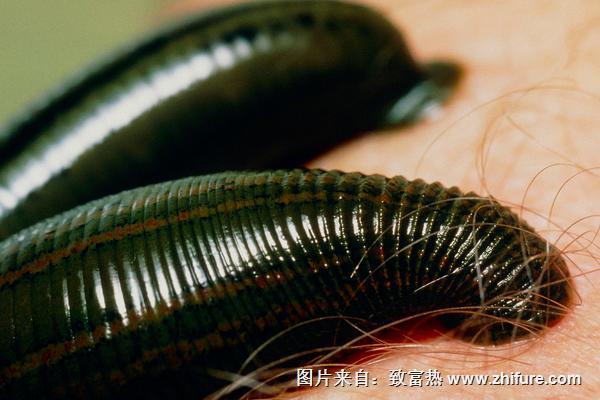 被水蛭咬了怎么辦？