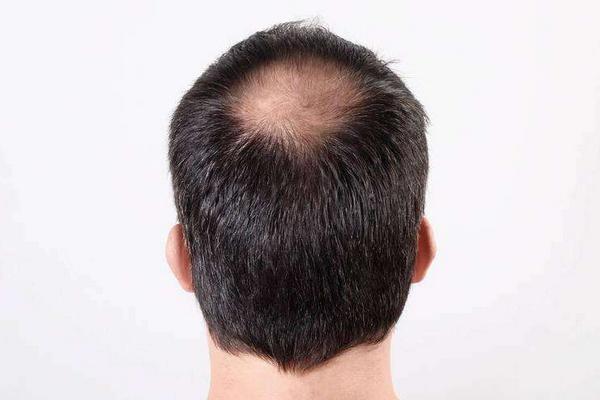 花椒生發(fā)嗎?