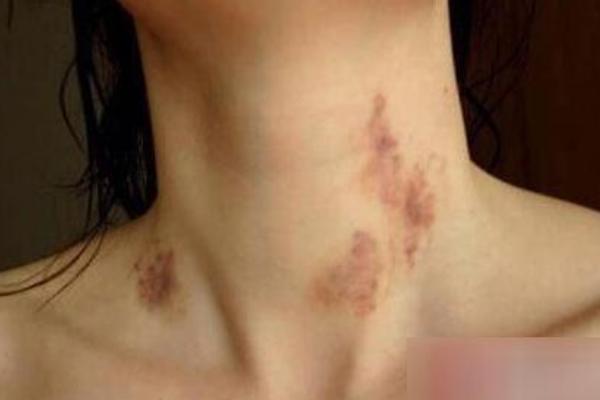 網友常說的種草莓是什么意思