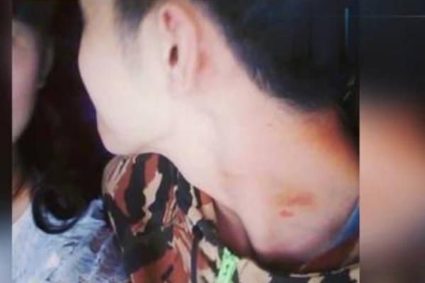 網友常說的種草莓是什么意思