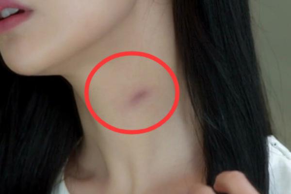 網友常說的種草莓是什么意思