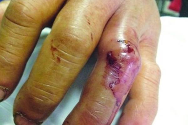 蜈蚣的天敵是什么？