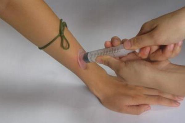 被蜈蚣咬了會死嗎?