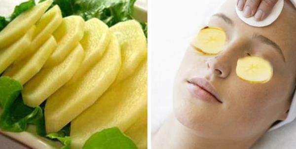 土豆片真的能去黑眼圈嗎 土豆怎么去黑眼圈