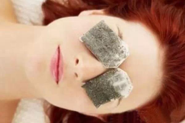 土豆片真的能去黑眼圈嗎 土豆怎么去黑眼圈