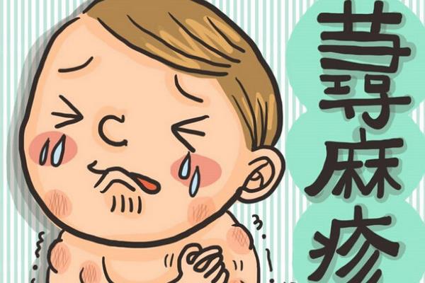 春季蕁麻疹怎么預防及治療 春季蕁麻疹怎么治療