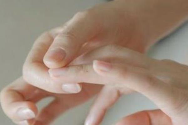 冬天手凍了生凍瘡了怎么辦 冬天怎么防止凍傷