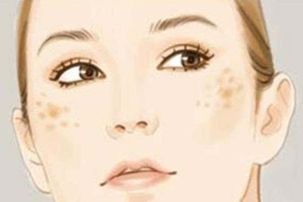 如何用白術(shù)祛斑 白術(shù)祛斑方法