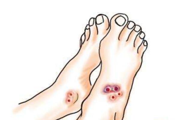 夢(mèng)見蛇咬人是什么意思 女人夢(mèng)到蛇咬人被打死了有什么預(yù)兆