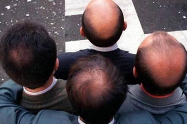 夢見自己禿頂是什么意思 女人夢到自己半禿頂有什么預兆