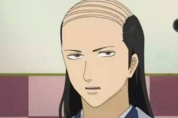 夢見自己禿頂是什么意思 女人夢到自己半禿頂有什么預兆