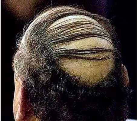 夢見自己禿頂是什么意思 女人夢到自己半禿頂有什么預兆