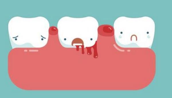 夢見掉門牙是什么意思 女人夢到自己2顆大門牙掉了有什么預兆