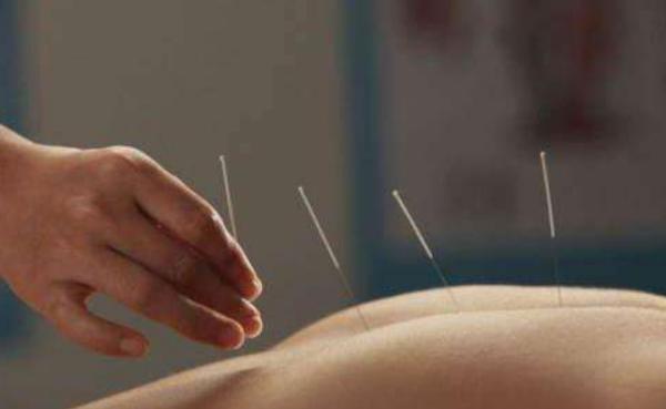 夢見扎針是什么意思 夢見別人給我扎針灸有什么預兆