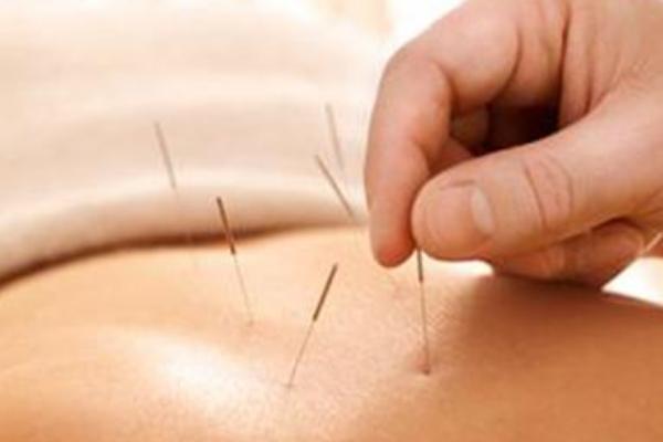 夢見扎針是什么意思 夢見別人給我扎針灸有什么預兆