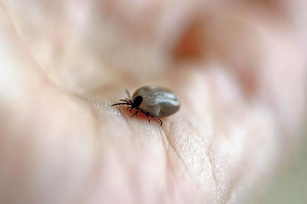 夢見吸血蟲有什么意思 女人夢到吸血蟲鉆到身體里有什么預兆