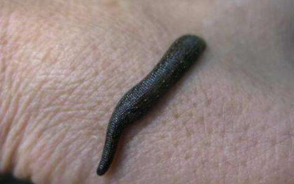 夢見螞蟥是什么意思 女人夢到身上很多螞蟥有什么預兆