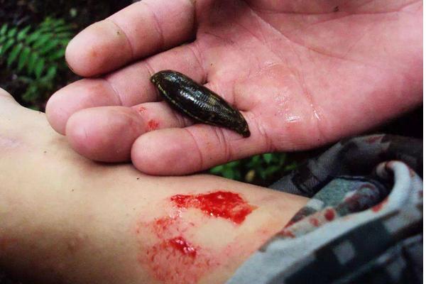 夢見螞蟥是什么意思 女人夢到身上很多螞蟥有什么預(yù)兆