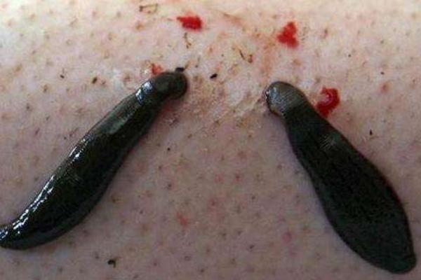 夢見螞蟥是什么意思 女人夢到身上很多螞蟥有什么預(yù)兆