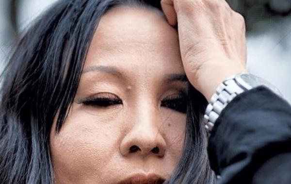 夢(mèng)見(jiàn)眼睛腫了是什么意思 女人夢(mèng)到自己眼睛腫了打不開(kāi)有什么預(yù)兆