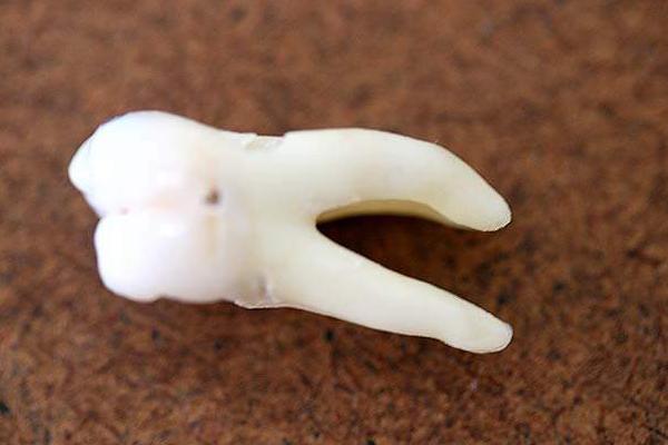 夢見掉牙齒是什么意思 夢到掉了一大把牙齒并吐出來有什么預兆