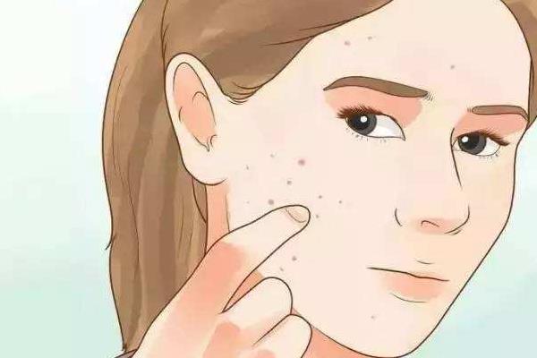 夢見自己過敏是什么意思 夢到自己全身是疙瘩有什么預兆