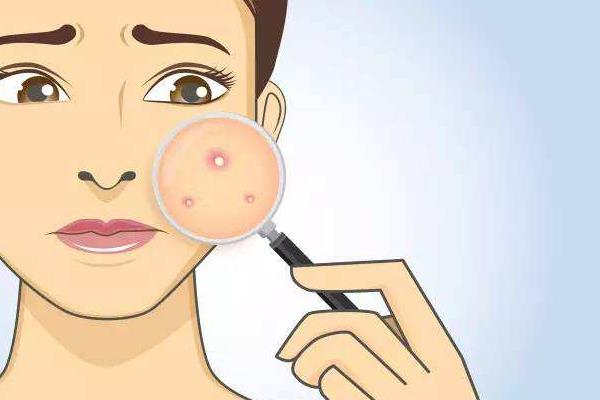 夢見自己過敏是什么意思 夢到自己全身是疙瘩有什么預兆