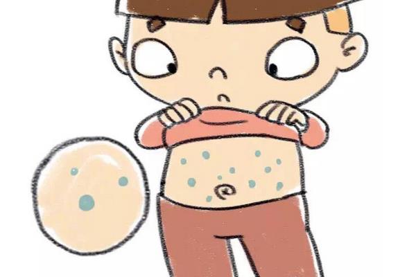 夢見自己過敏是什么意思 夢到自己全身是疙瘩有什么預兆