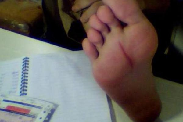 夢見腳腫是什么意思 女人夢到自己的腳水腫了有什么預兆