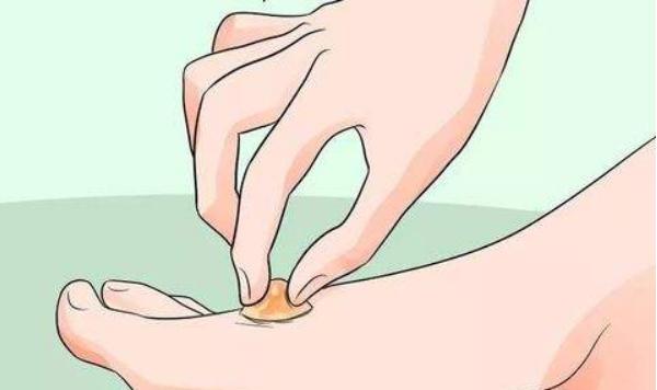 夢見腳上長水泡是什么意思 夢到腳上長瘡有什么預兆