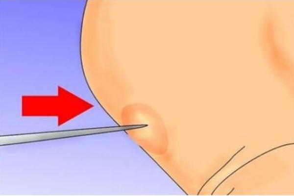 夢見腳上長水泡是什么意思 夢到腳上長瘡有什么預兆