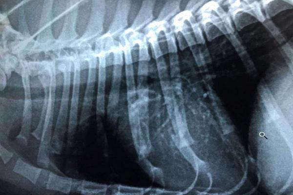 夢見肋骨斷了是什么意思 男生夢到自己肋骨斷了一根有什么預兆