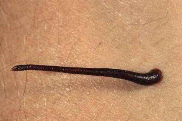 被水蛭吸血疼嗎 水蛭吸血后為什么死掉