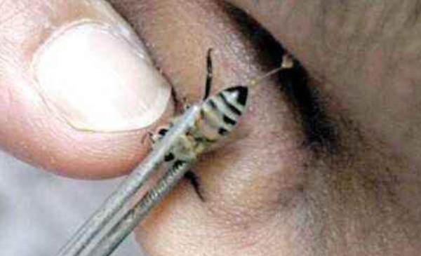 蜂毒市場價格多少錢一克 蜂毒的功效與作用及禁忌