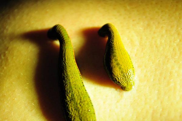 螞蝗吃到肚子里怎么辦 螞蟥在人體里能活多久