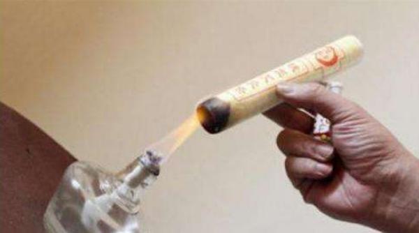 艾灸減肥灸哪些部位 艾灸減肥一個月瘦多少