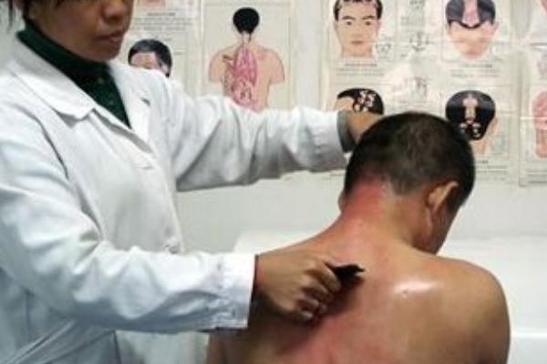 刮痧和拔罐的區(qū)別是什么 刮痧和拔罐可以一起做嗎