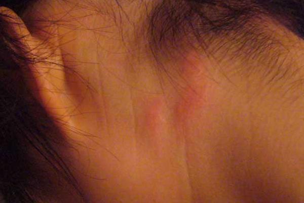 貓身上有虱子怎么辦 貓虱子怎么去除