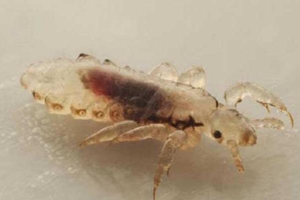 虱子是怎么產生的 人為什么長虱子