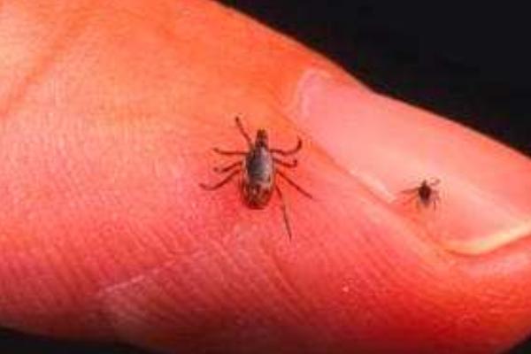 虱子卵怎么徹底去除 虱子卵幾天變成虱子