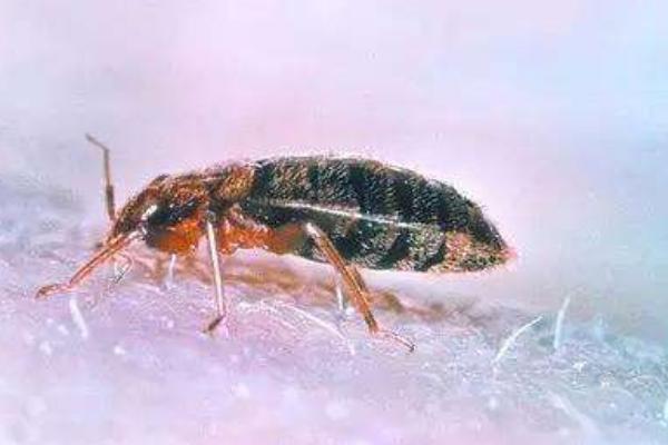 小孩頭上長虱子怎么辦 女孩頭上有虱子怎么辦