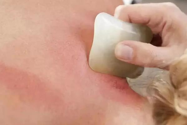 正確的后背刮痧手法圖 刮痧后背部顏色判斷