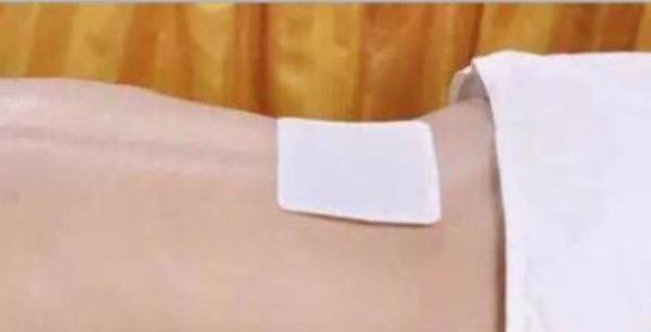 艾灸貼市場價格多少錢一盒 艾灸貼有用嗎