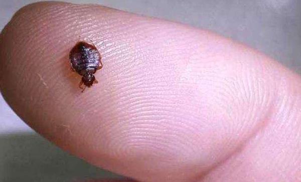 虱子和跳蚤的區別是什么 跳蚤咬的疤痕怎么去除