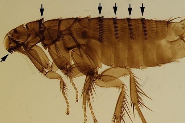 生虱子的原因 頭上為什么會長虱子